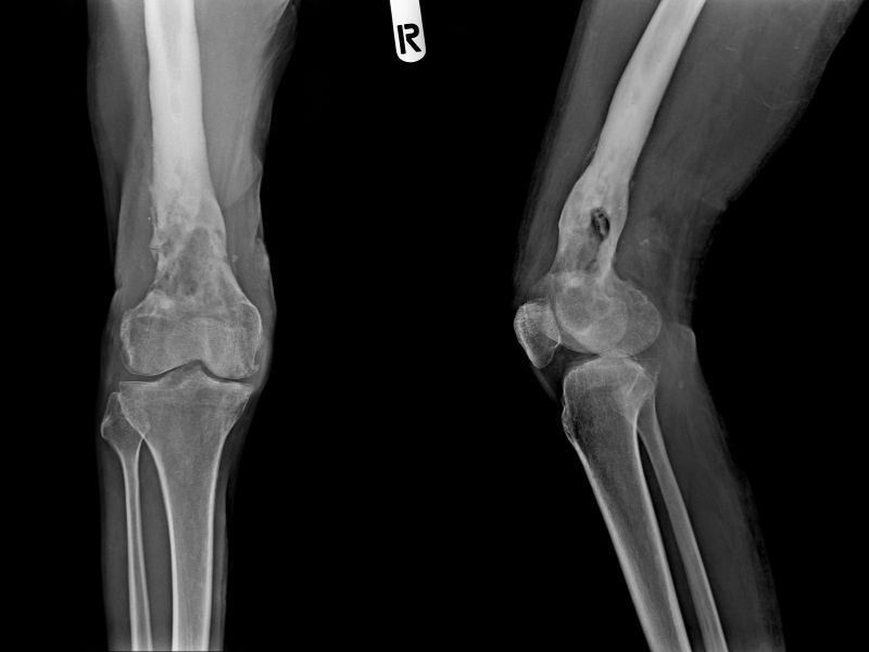 diagnostyka obrazowa a funkcjonalna - czego nie widać na RTG